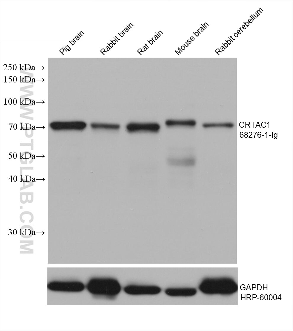 Western Blot (WB) analysis of various lysates using CRTAC1 Monoclonal antibody (68276-1-Ig)