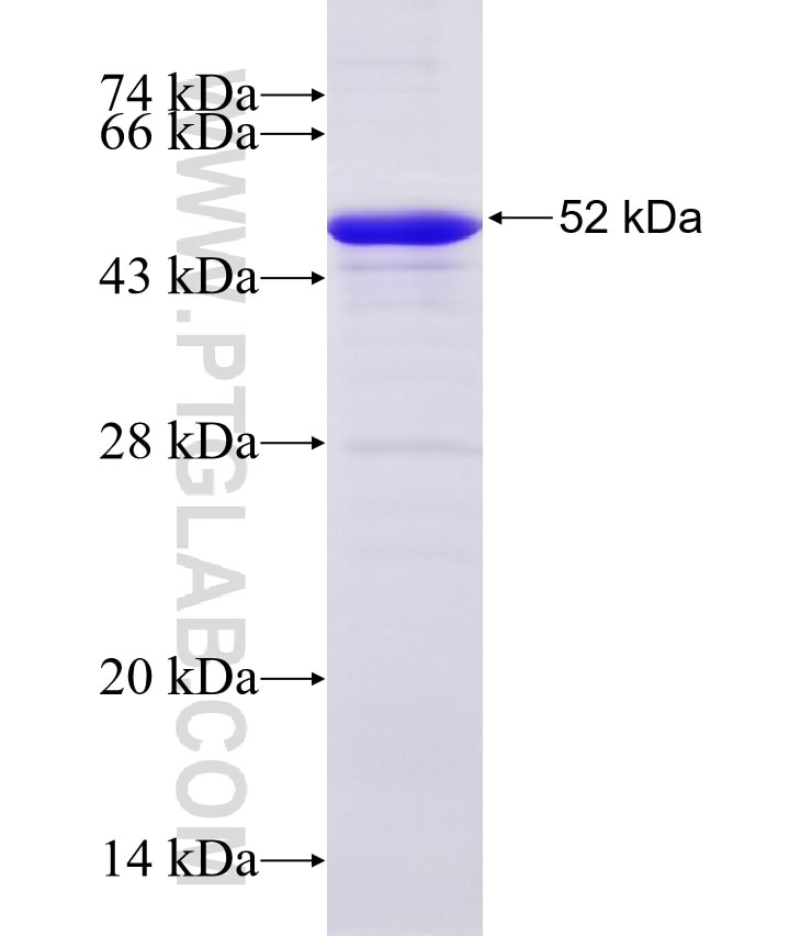 CRTAC1 fusion protein Ag32813 SDS-PAGE