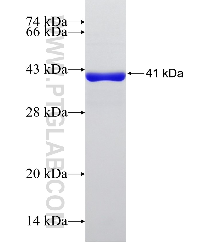 CRTAC1 fusion protein Ag32963 SDS-PAGE