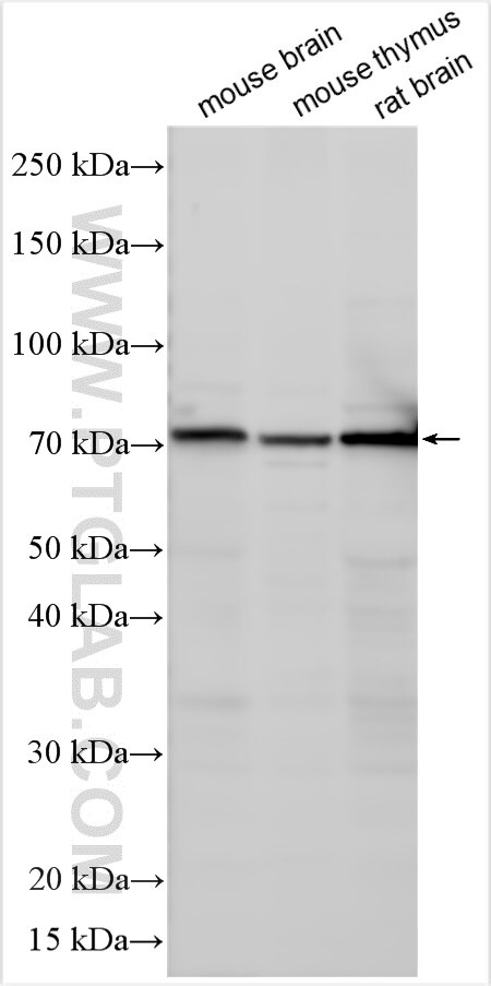 Western Blot (WB) analysis of various lysates using CRTAM Polyclonal antibody (16627-1-AP)