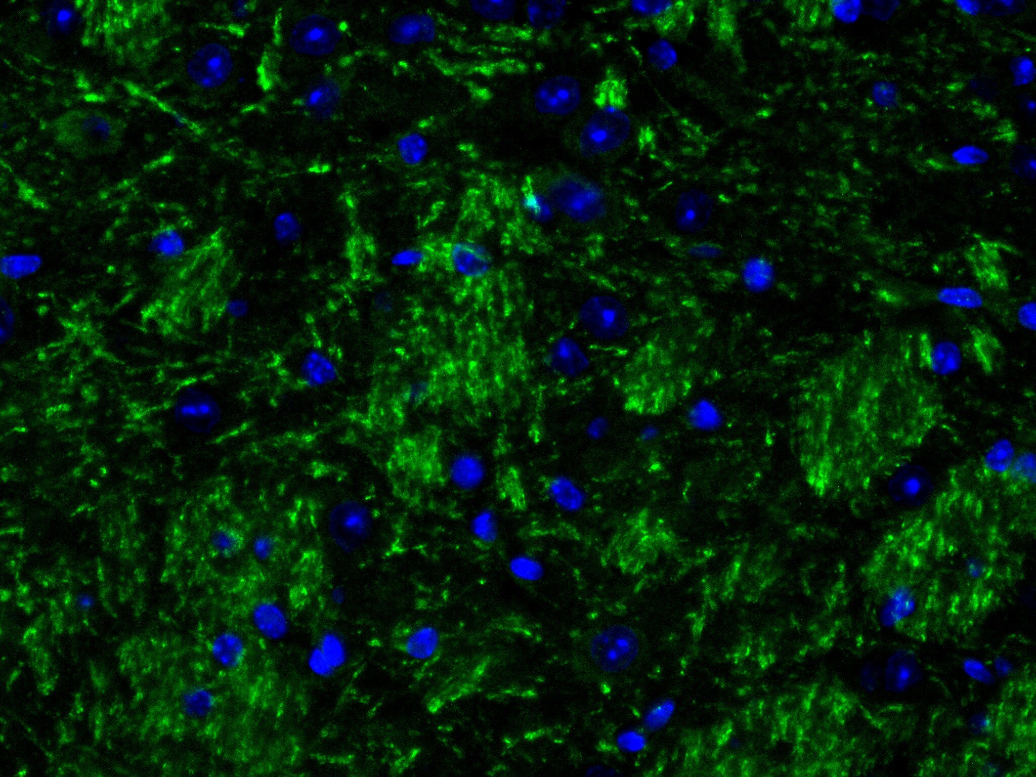 Immunofluorescence (IF) / fluorescent staining of mouse brain tissue using CRTAM/CD355 Recombinant antibody (84068-4-RR)