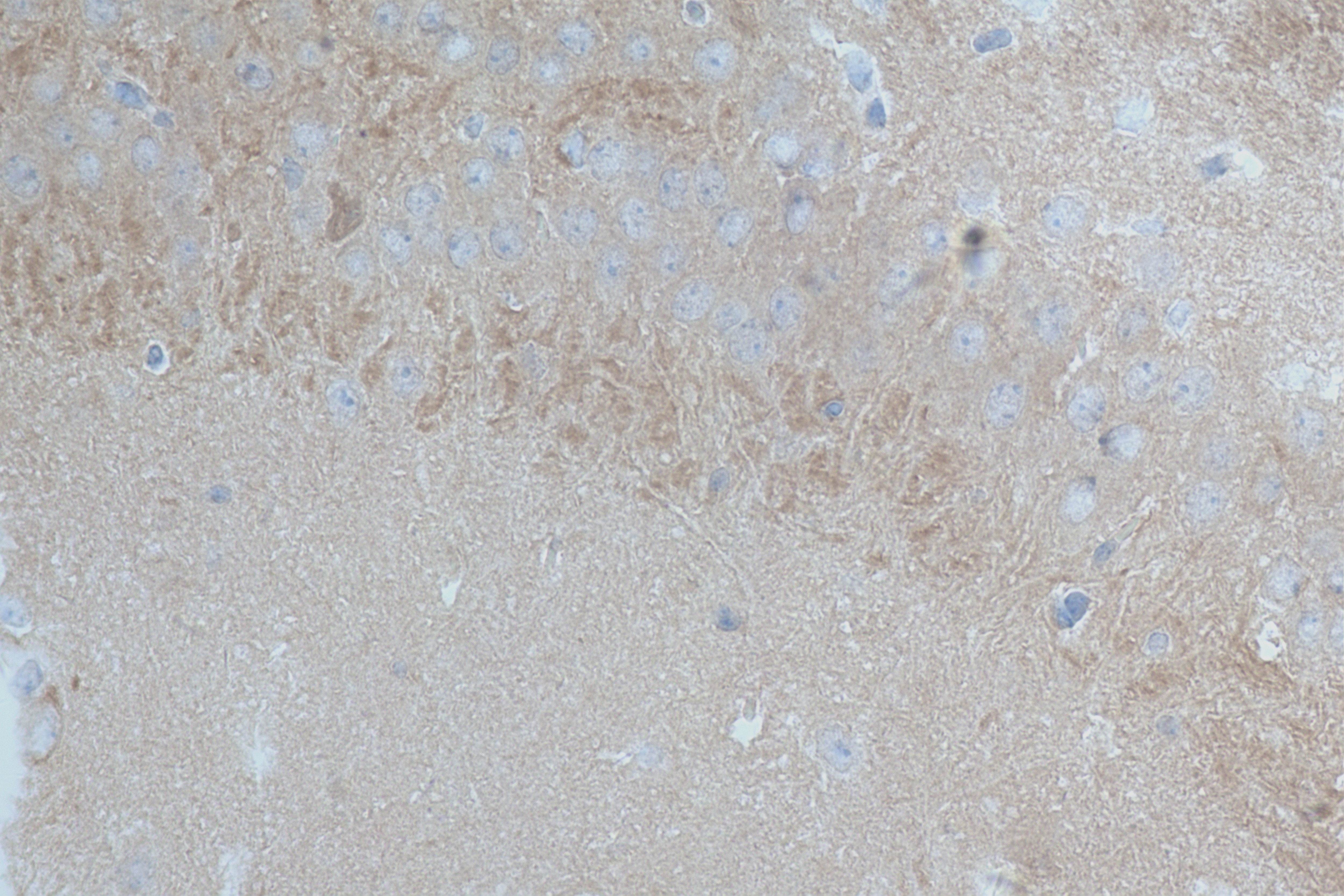 Immunohistochemistry (IHC) staining of mouse brain tissue using CRTAM/CD355 Recombinant antibody (84068-4-RR)