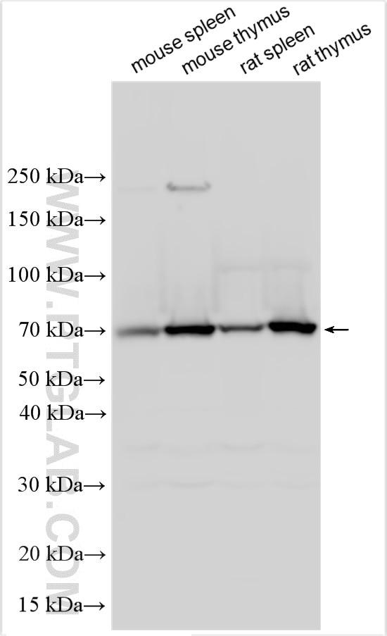 WB analysis using 32680-1-AP Western Blot (WB) analysis of various lysates using CRTAM/CD355 Polyclonal antibody (32680-1-AP)