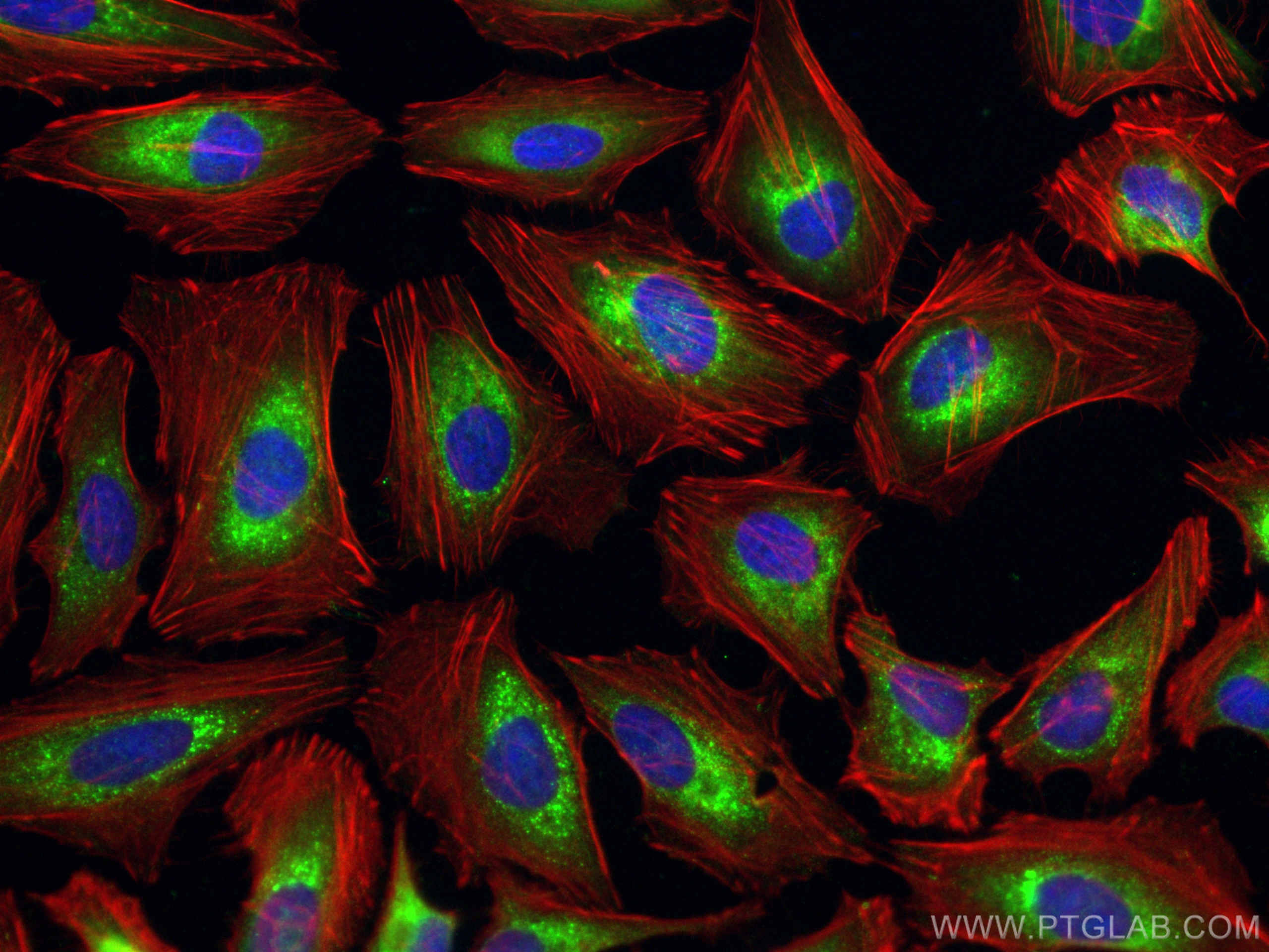 Immunofluorescence (IF) / fluorescent staining of HeLa cells using CRTAP Polyclonal antibody (15724-1-AP)