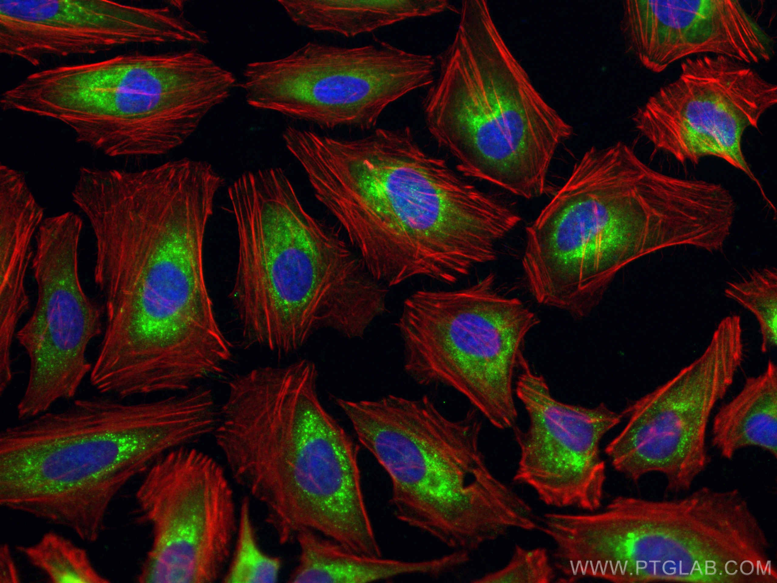 IF Staining of HeLa using 15724-1-AP