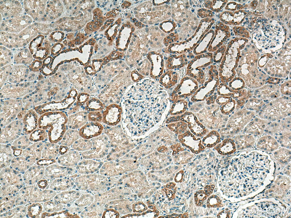 Immunohistochemistry (IHC) staining of human kidney tissue using CRTAP Polyclonal antibody (15724-1-AP)