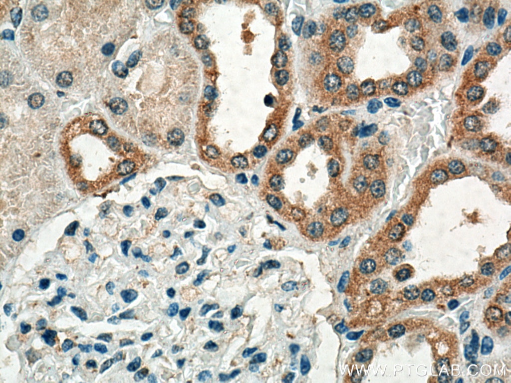 Immunohistochemistry (IHC) staining of human kidney tissue using CRTAP Polyclonal antibody (15724-1-AP)