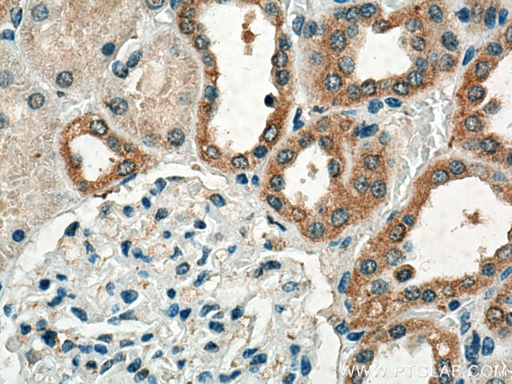 IHC staining of human kidney using 15724-1-AP