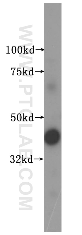 Western Blot (WB) analysis of HeLa cells using CRTAP Polyclonal antibody (15724-1-AP)