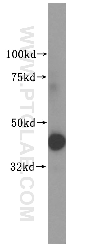 Western Blot (WB) analysis of HEK-293 cells using CRTAP Polyclonal antibody (15724-1-AP)