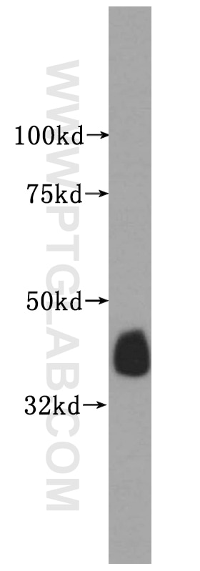 Western Blot (WB) analysis of human colon tissue using CRTAP Polyclonal antibody (15724-1-AP)