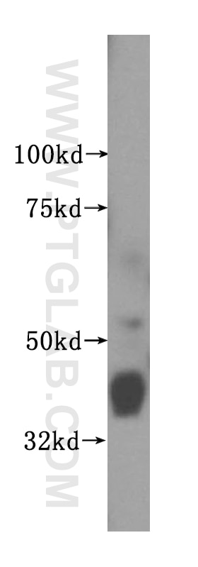 Western Blot (WB) analysis of human stomach tissue using CRTAP Polyclonal antibody (15724-1-AP)