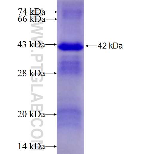 CRTAP fusion protein Ag8456 SDS-PAGE