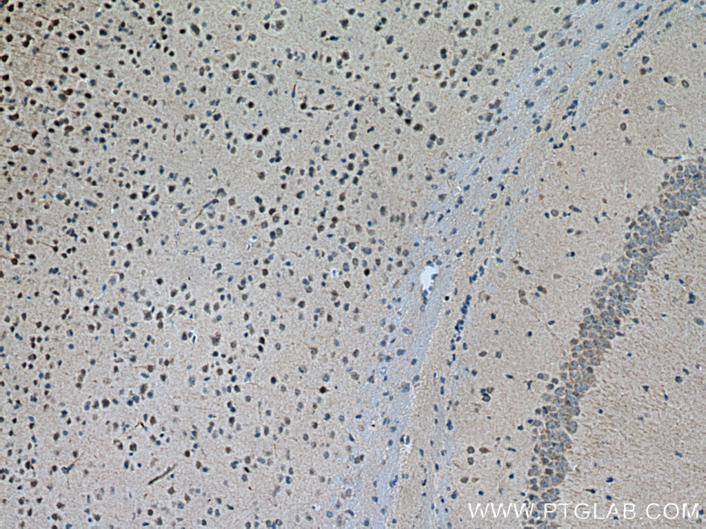 Immunohistochemistry (IHC) staining of mouse brain tissue using TORC1/CRTC1 Polyclonal antibody (10441-1-AP)