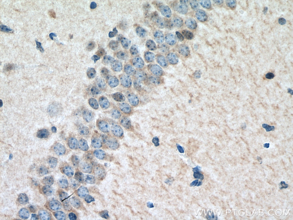 Immunohistochemistry (IHC) staining of mouse brain tissue using TORC1/CRTC1 Polyclonal antibody (10441-1-AP)