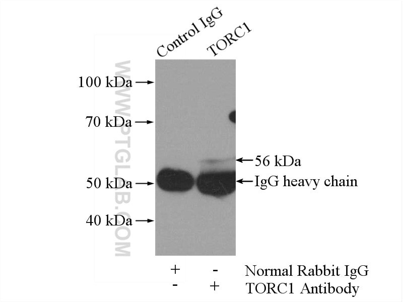 Immunoprecipitation (IP) experiment of mouse kidney tissue using TORC1/CRTC1 Polyclonal antibody (10441-1-AP)