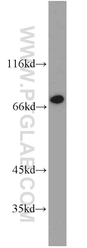 Western Blot (WB) analysis of A431 cells using TORC1/CRTC1 Polyclonal antibody (10441-1-AP)