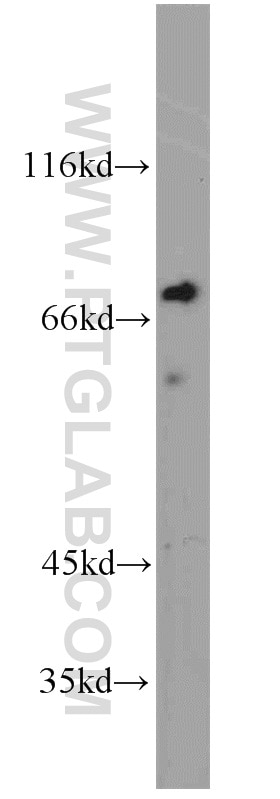 Western Blot (WB) analysis of Jurkat cells using TORC1/CRTC1 Polyclonal antibody (10441-1-AP)