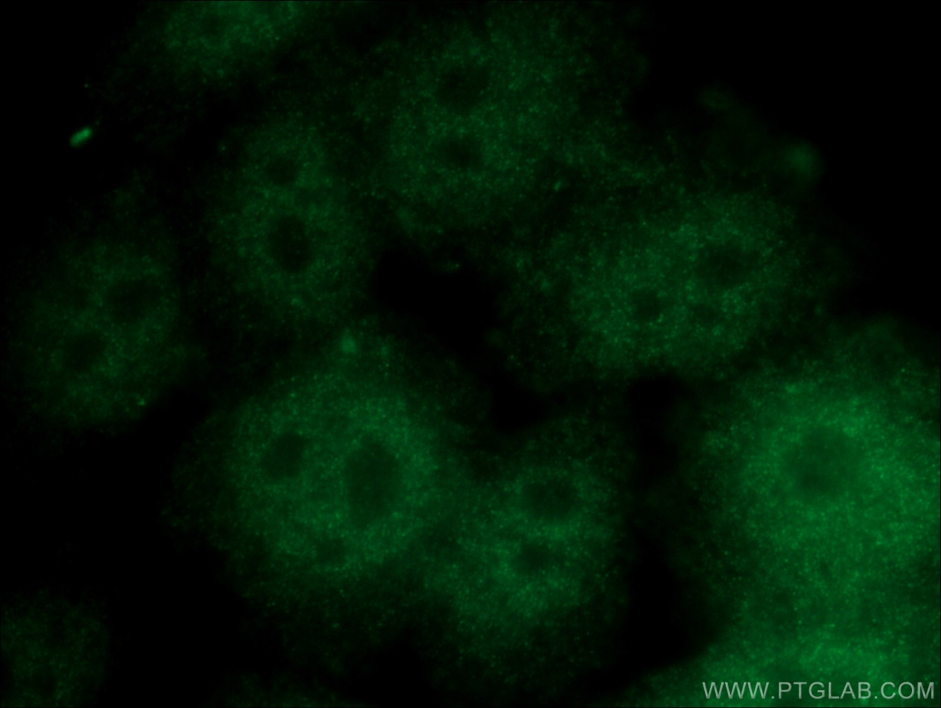 Immunofluorescence (IF) / fluorescent staining of HeLa cells using CRTC2,TORC2 Polyclonal antibody (12497-1-AP)