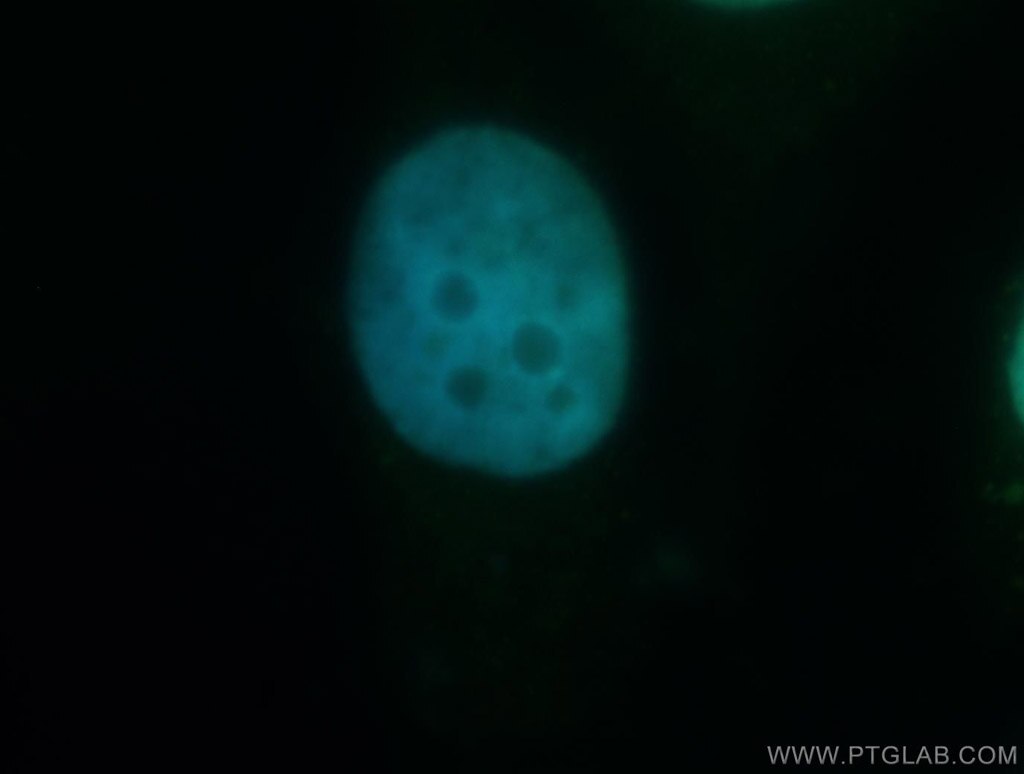 IF Staining of HeLa using 12497-1-AP