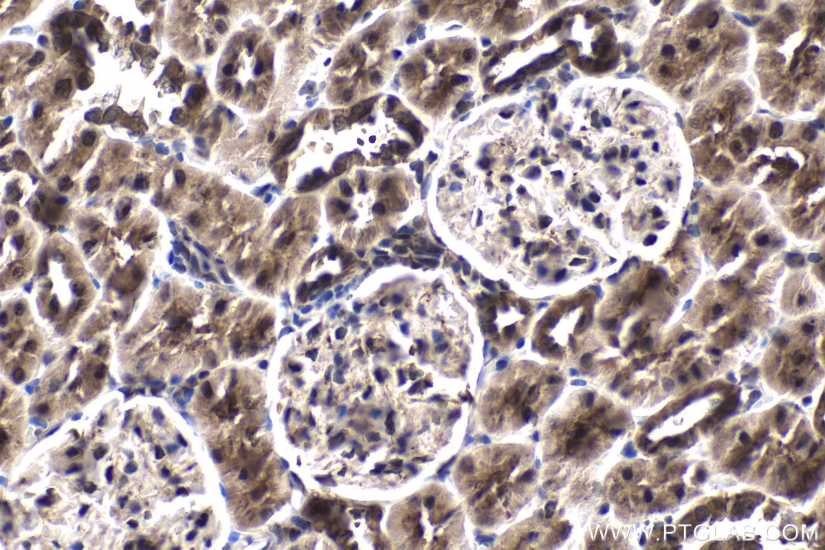 Immunohistochemistry (IHC) staining of rat kidney tissue using CRTC2,TORC2 Polyclonal antibody (12497-1-AP)