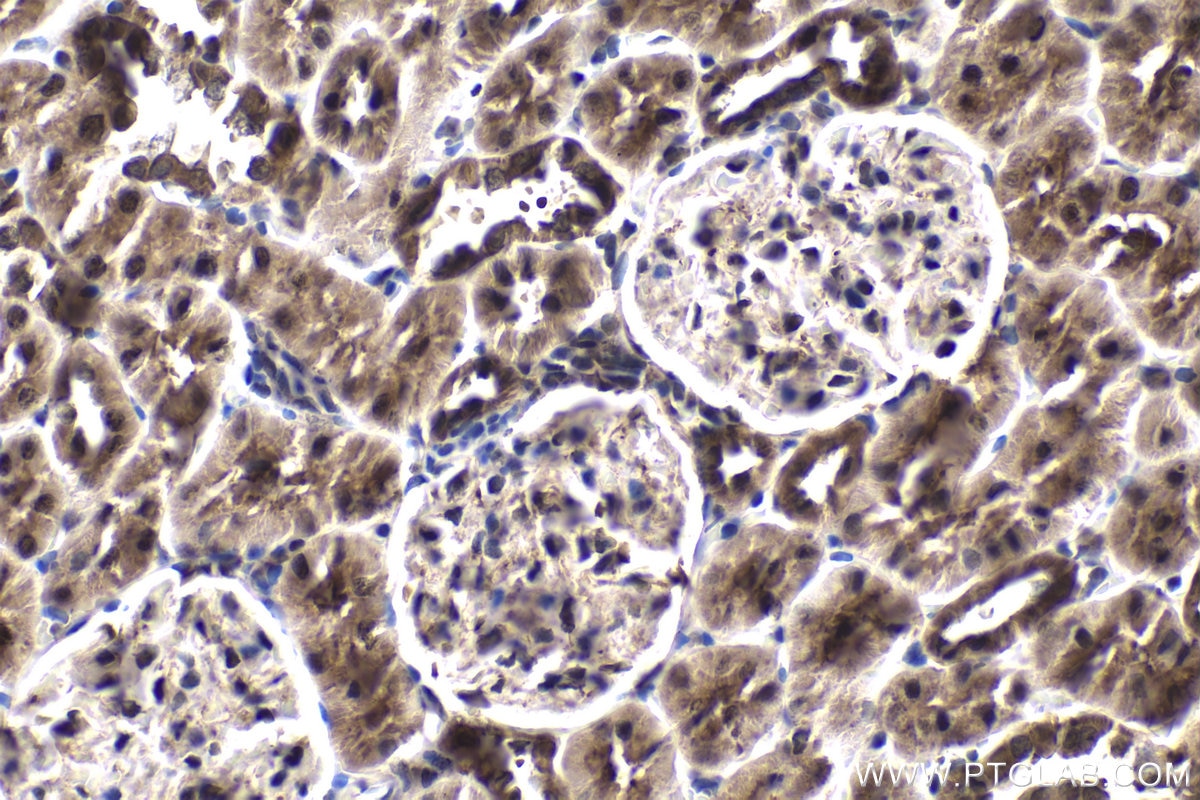 IHC staining of rat kidney using 12497-1-AP