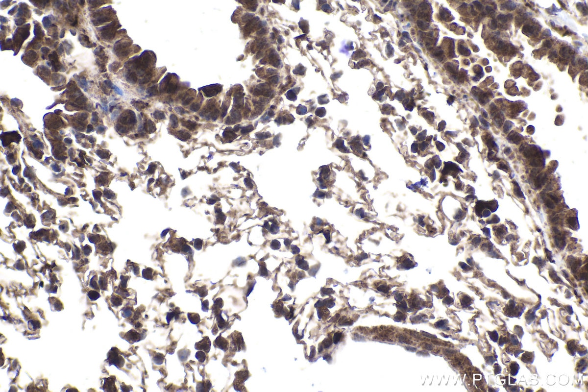Immunohistochemistry (IHC) staining of mouse lung tissue using CRTC2,TORC2 Polyclonal antibody (12497-1-AP)