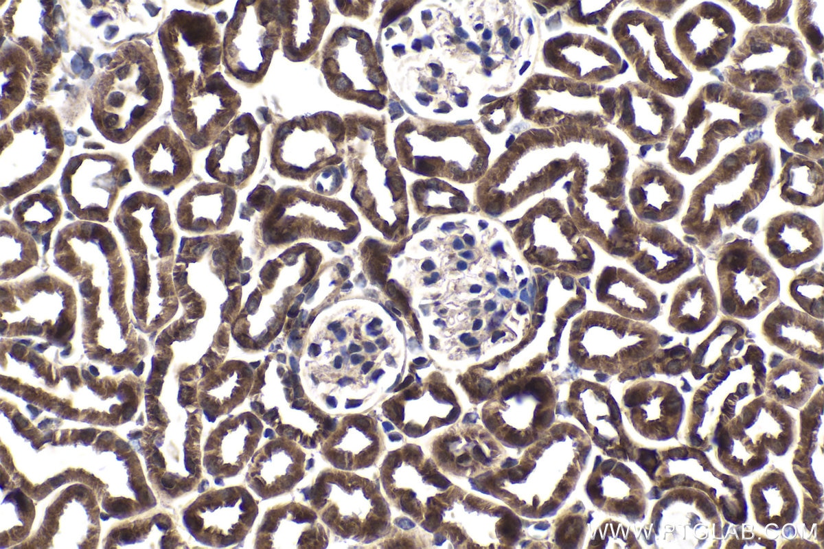 Immunohistochemistry (IHC) staining of mouse kidney tissue using CRTC2,TORC2 Polyclonal antibody (12497-1-AP)