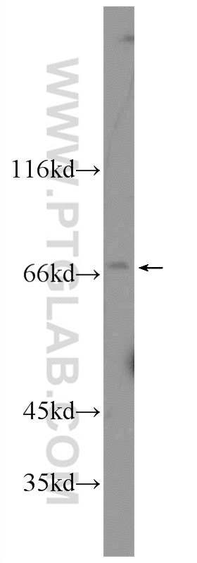 Western Blot (WB) analysis of mouse liver tissue using CRTC2,TORC2 Polyclonal antibody (12497-1-AP)