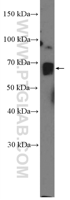 Western Blot (WB) analysis of mouse brain tissue using CRTC3 Polyclonal antibody (25476-1-AP)