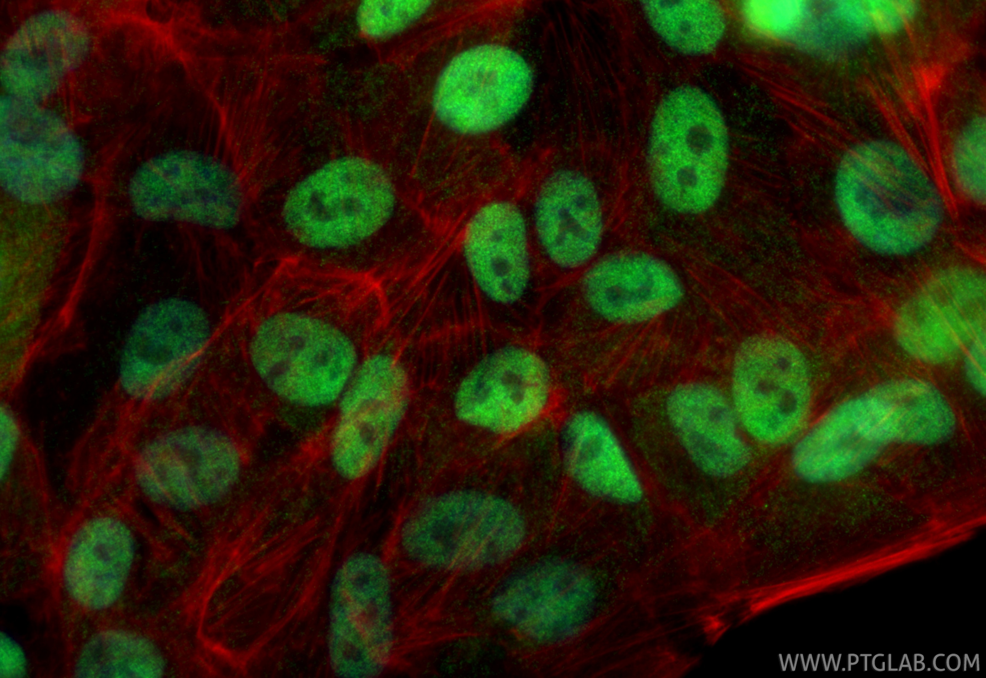 Immunofluorescence (IF) / fluorescent staining of hTERT-RPE1 cells using CRX Polyclonal antibody (12047-1-AP)