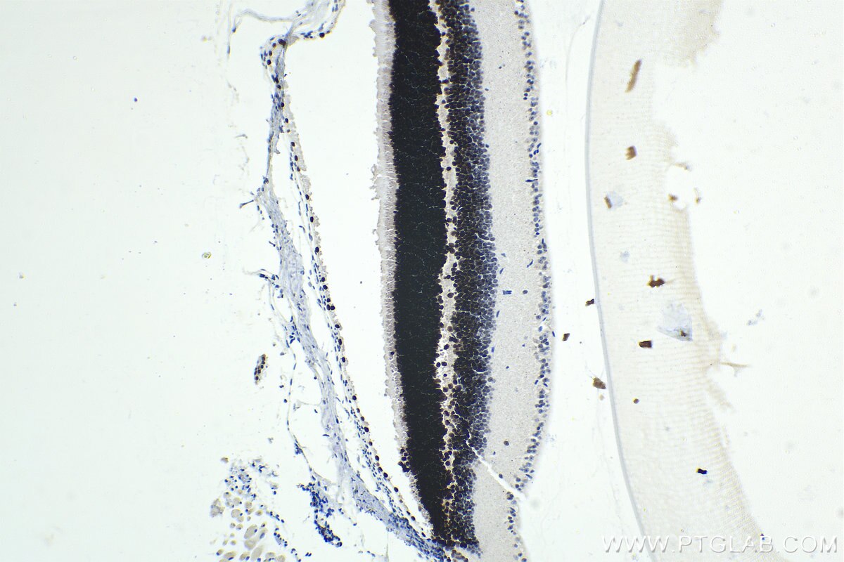 Immunohistochemistry (IHC) staining of mouse eye tissue using CRX Polyclonal antibody (12047-1-AP)