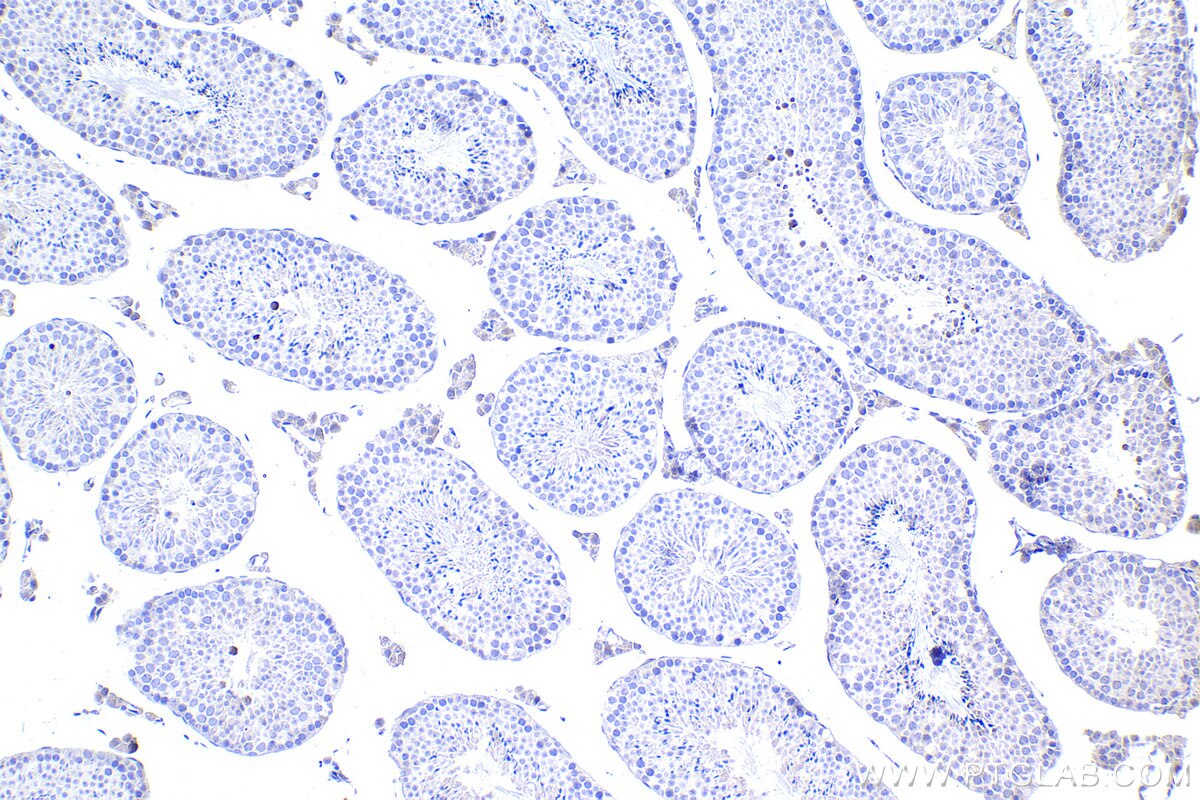 Immunohistochemistry (IHC) staining of mouse testis tissue using CRX Polyclonal antibody (12047-1-AP)