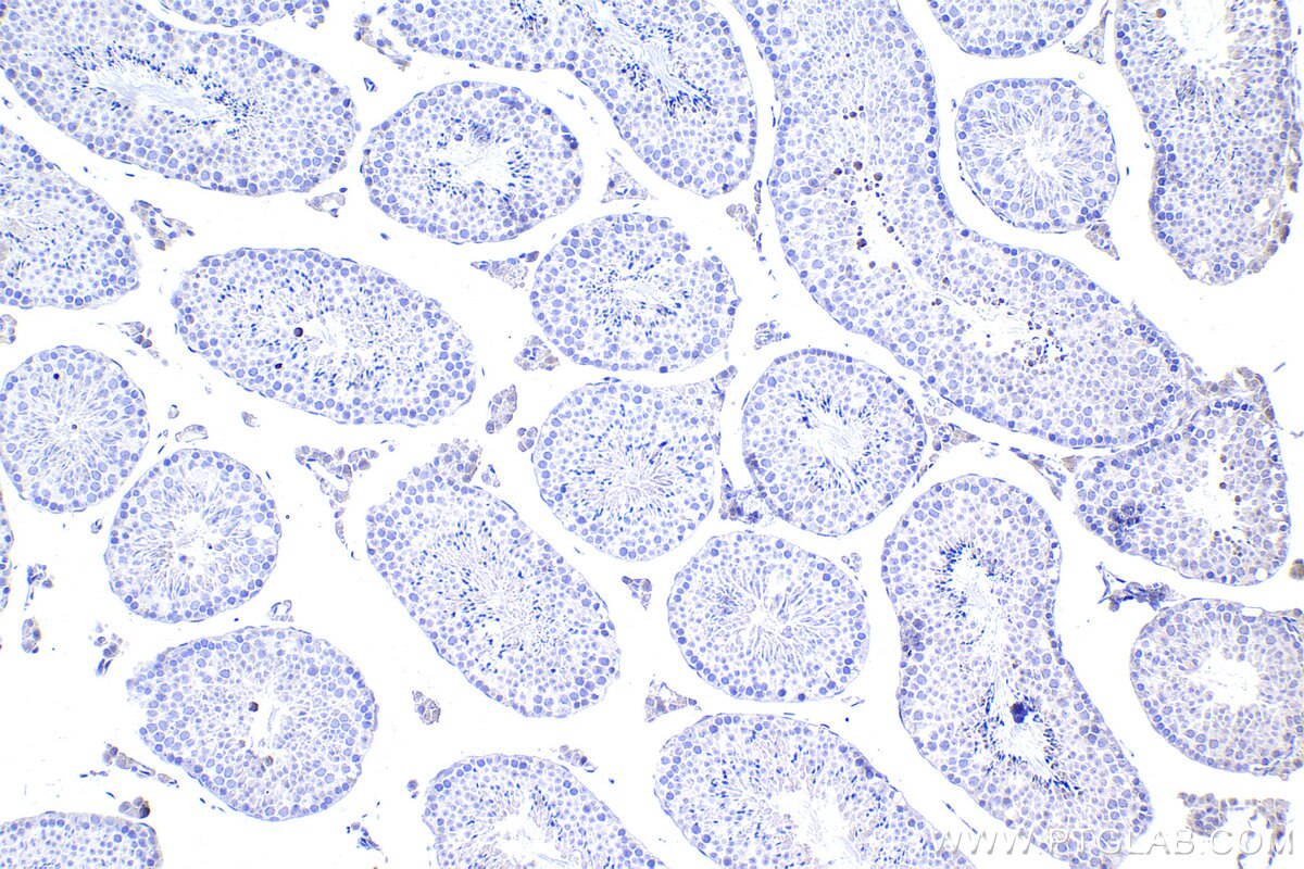 IHC staining of mouse testis using 12047-1-AP