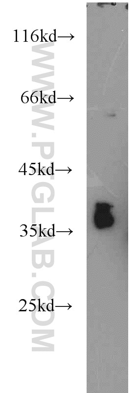 Western Blot (WB) analysis of Y79 cells using CRX Polyclonal antibody (12047-1-AP)