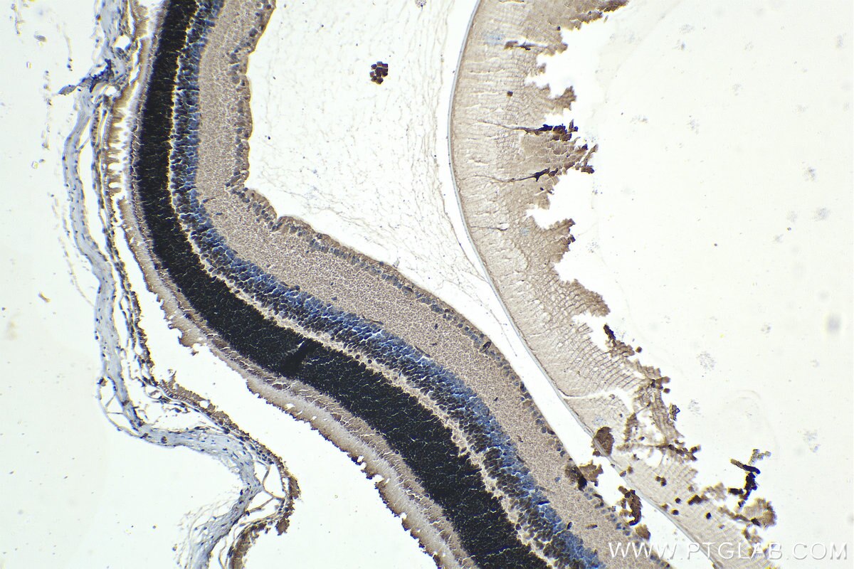 Immunohistochemistry (IHC) staining of mouse eye tissue using CRX Monoclonal antibody (67555-1-Ig)