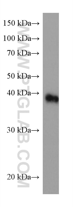 Western Blot (WB) analysis of Y79 cells using CRX Monoclonal antibody (67555-1-Ig)