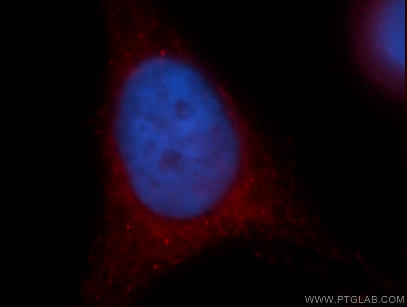 Immunofluorescence (IF) / fluorescent staining of HeLa cells using Cryptochrome 1 Polyclonal antibody (13474-1-AP)