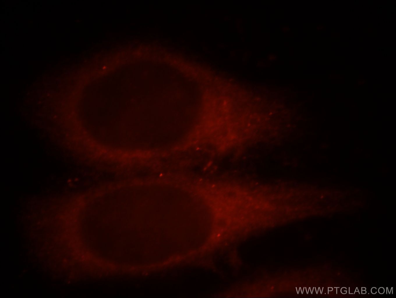 IF Staining of MCF-7 using 13474-1-AP