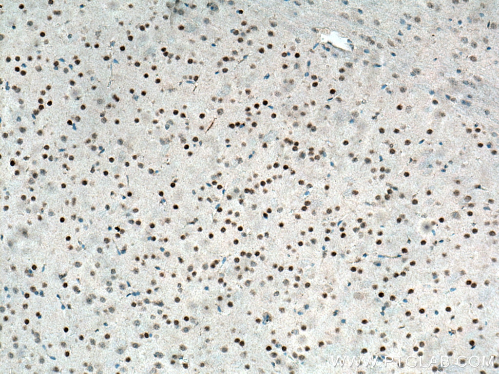 Immunohistochemistry (IHC) staining of mouse brain tissue using Cryptochrome 1 Polyclonal antibody (13474-1-AP)
