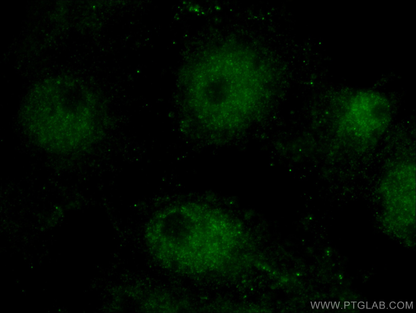 Immunofluorescence (IF) / fluorescent staining of SH-SY5Y cells using Cryptochrome 2 Polyclonal antibody (13997-1-AP)