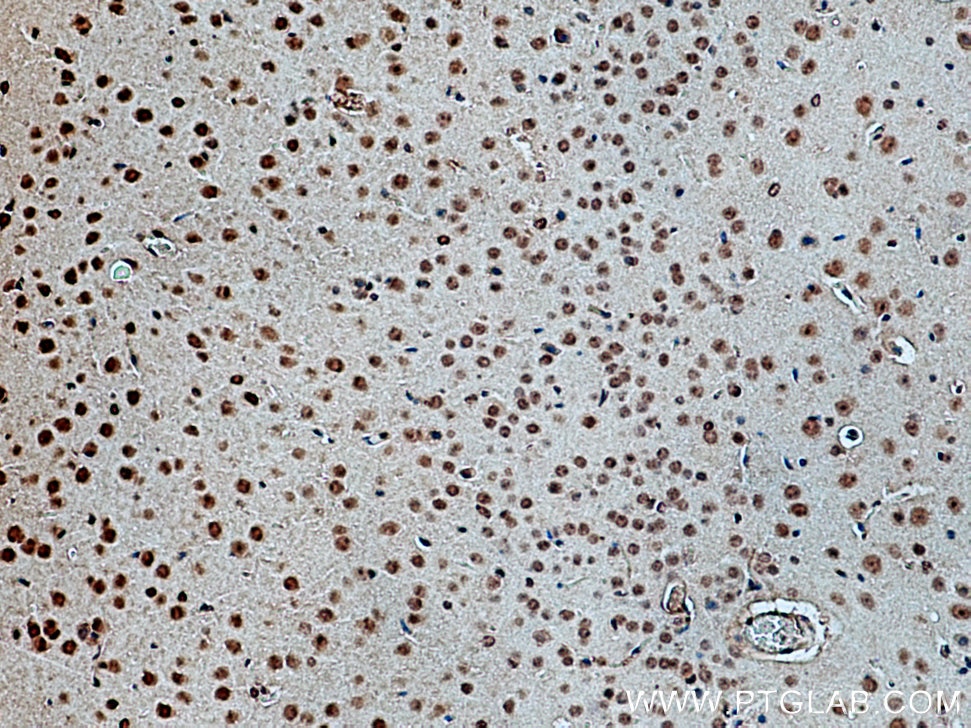 Immunohistochemistry (IHC) staining of mouse brain tissue using Cryptochrome 2 Polyclonal antibody (13997-1-AP)