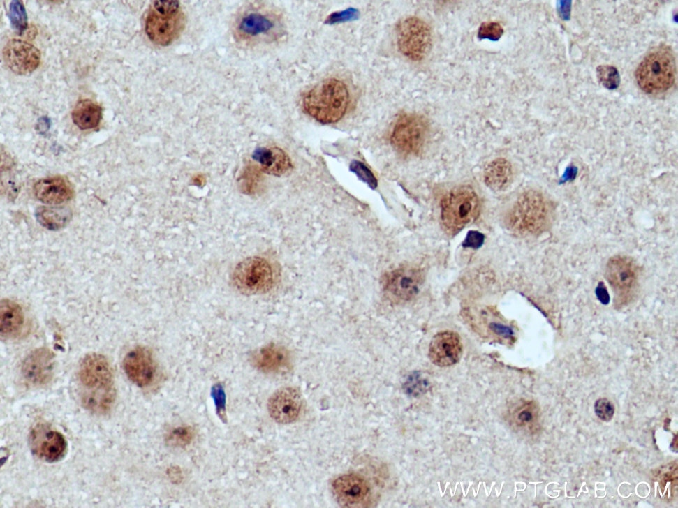 Immunohistochemistry (IHC) staining of mouse brain tissue using Cryptochrome 2 Polyclonal antibody (13997-1-AP)