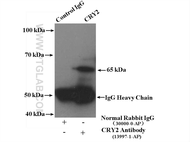 Immunoprecipitation (IP) experiment of mouse brain tissue using Cryptochrome 2 Polyclonal antibody (13997-1-AP)