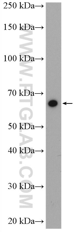 Western Blot (WB) analysis of mouse brain tissue using Cryptochrome 2 Polyclonal antibody (13997-1-AP)