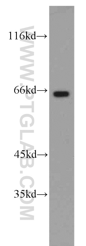 Western Blot (WB) analysis of Y79 cells using Cryptochrome 2 Polyclonal antibody (13997-1-AP)