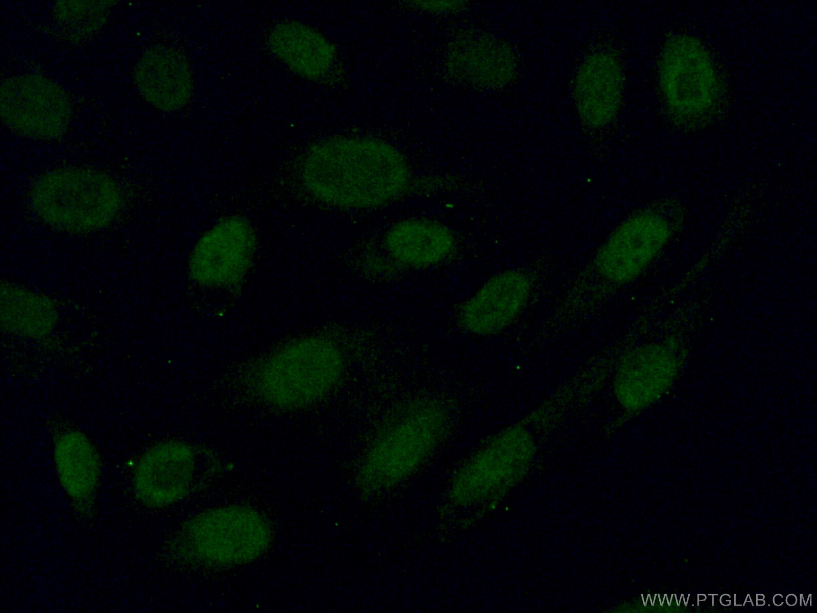 Immunofluorescence (IF) / fluorescent staining of U2OS cells using Alpha B Crystallin Polyclonal antibody (15808-1-AP)