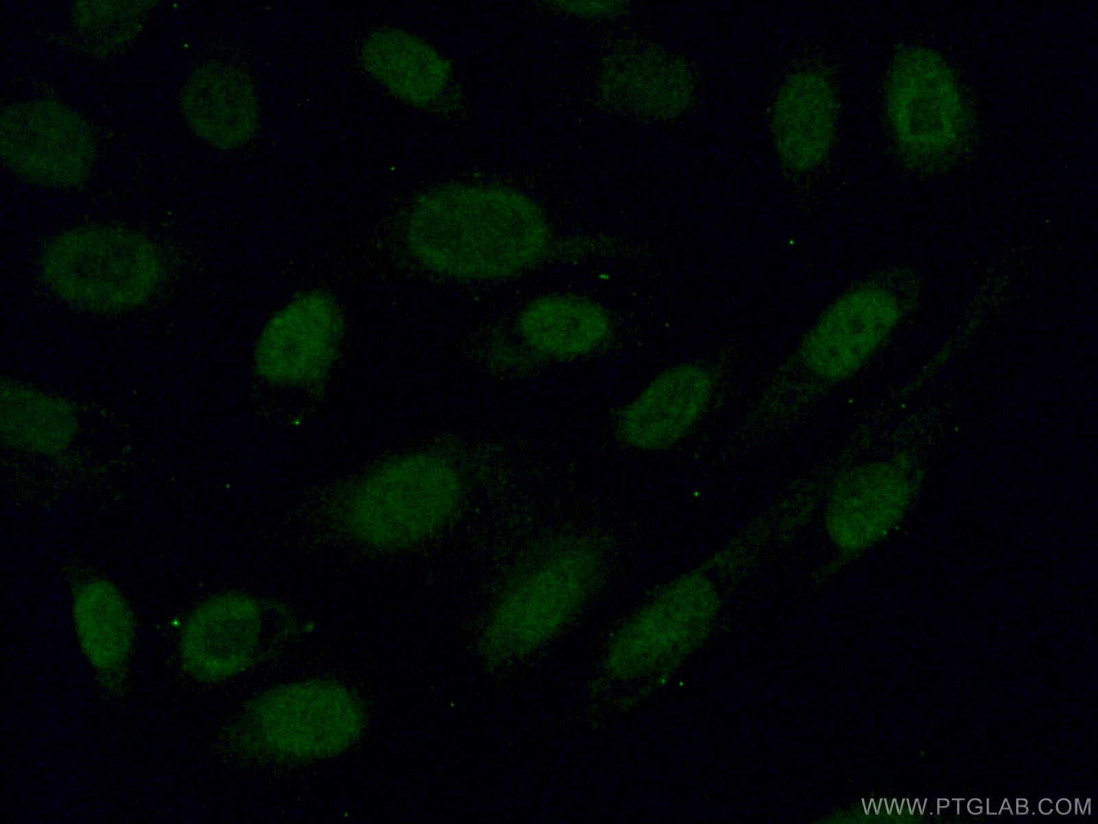 IF Staining of U2OS using 15808-1-AP