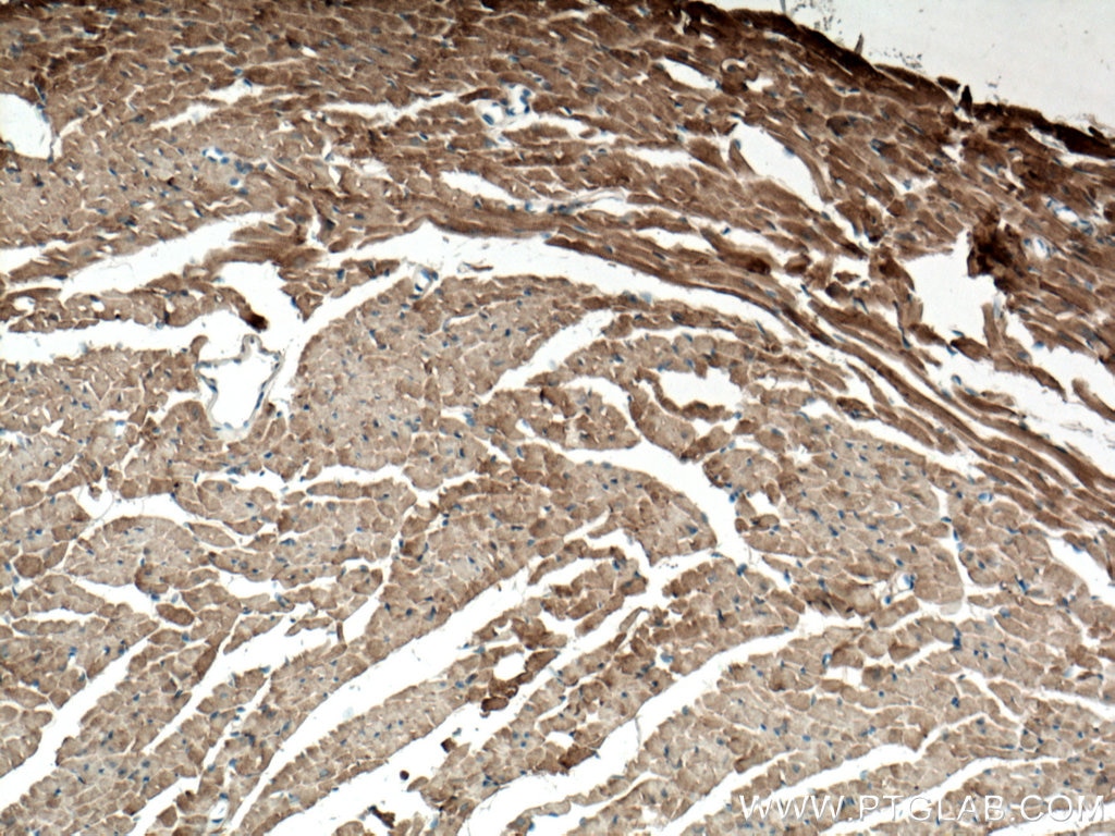 Immunohistochemistry (IHC) staining of mouse heart tissue using Alpha B Crystallin Polyclonal antibody (15808-1-AP)