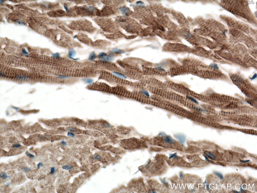 IHC staining of mouse heart using 15808-1-AP